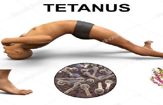tetanus